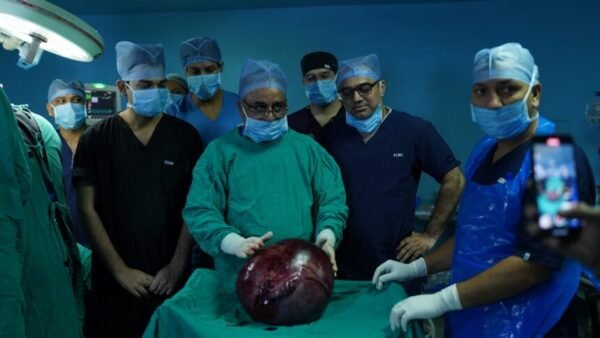 श्री महंत इन्दिरेश अस्पताल के डॉक्टरों ने निकाला 13 किलो का ओवेरियन ट्यूमर