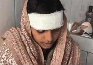 देहरादून: कैफे के बाहर युवती पर हमला, सिर में 8–9 टांके देहरादून में युवती पर हिंसक हमला | कैफे के बाहर सिर पर वार, 8–9 टांके